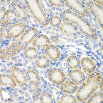 UBXD9 / ASPL Antibody (aa284-553)