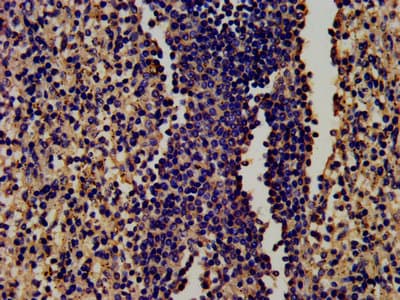 LF / LTF / Lactoferrin Antibody