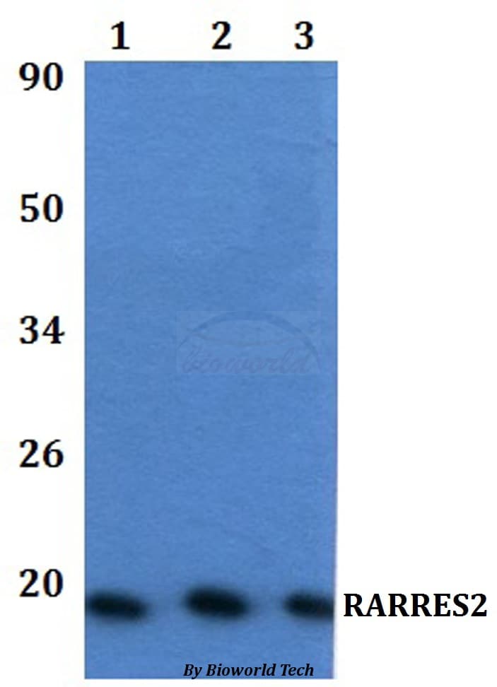 Polyclonal Rabbit anti-Human RARRES2 / Chemerin Antibody (WB)