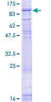 Human POMT2 Protein (Recombinant GST)