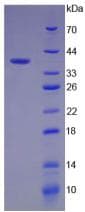 Human INSR / Insulin Receptor Protein (Recombinant His)