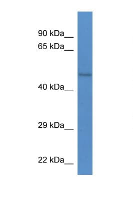 Polyclonal Rabbit anti-Mouse STK32B Antibody (aa60-109, WB)