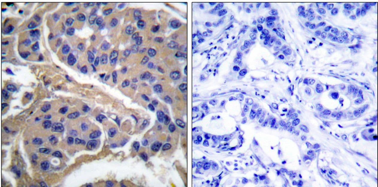 IRS1 Antibody (phospho-Ser307)