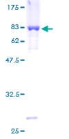 Human TS / Thromboxane Synthase Protein (Recombinant GST)