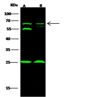 Polyclonal Rabbit anti-Human TRAF6 Antibody (Preservative Free, IF, WB)