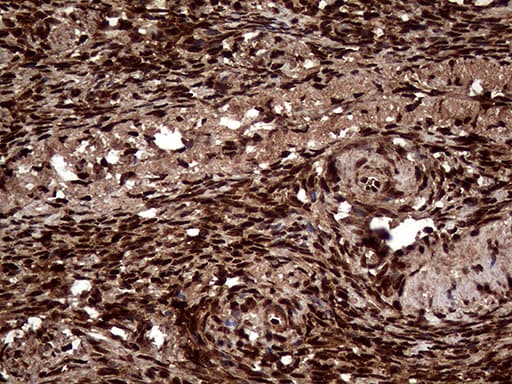 TALDO1 / Transaldolase 1 Antibody (clone OTI2E4)
