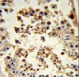 Polyclonal Rabbit anti-Human HSP90AB1 / HSP90 Alpha B1 Antibody (aa697-724, IHC, WB)