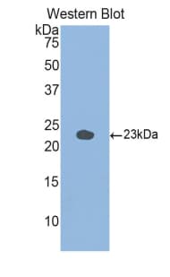 GAA / Alpha-Glucosidase, Acid Antibody (aa755-953, APC)