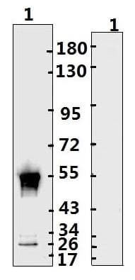 SARS-CoV-2 Nucleoprotein Antibody