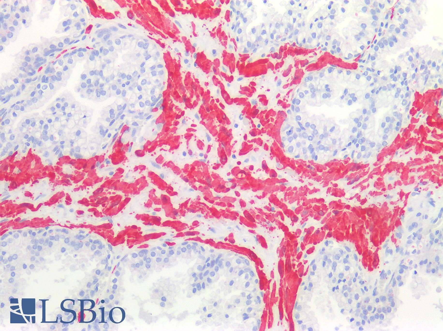 IHC-plus™ Polyclonal Rabbit anti-Human TAGLN / Transgelin / SM22 Antibody (IHC, IF, WB)