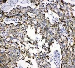 Polyclonal Rabbit anti-Human HSPA9 / Mortalin / GRP75 Antibody (aa591-609, IHC, WB)