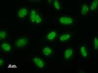 Monoclonal Mouse anti-Human LSM8 / NAA38 Antibody (clone 2527C6a, IF, WB)