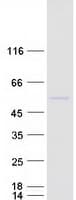 Human NOB1 / NOB1P Protein (Recombinant Myc-DDK (Flag))