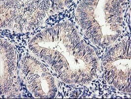 CYP2J2 Antibody (clone OTI5C5)