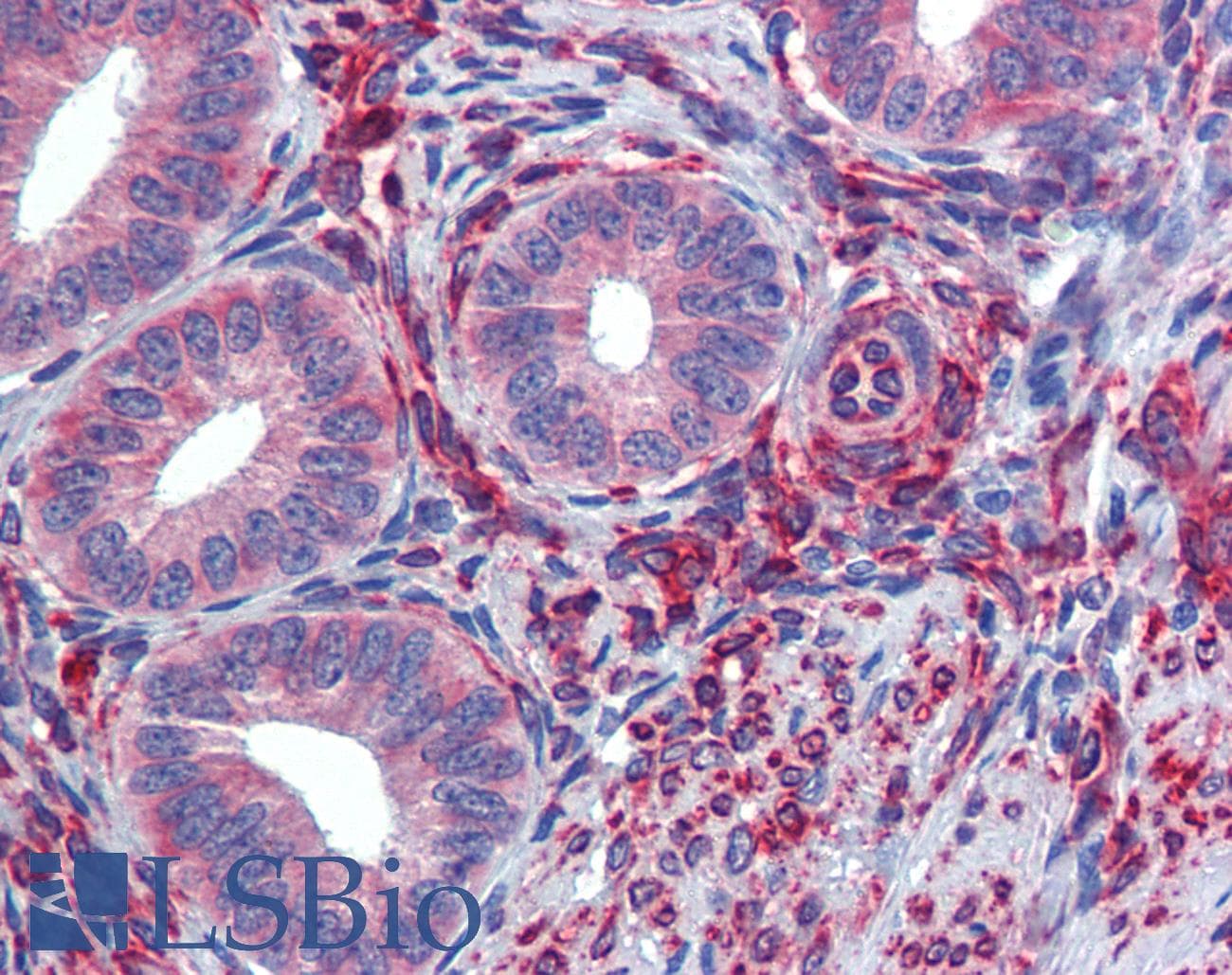IHC-plus™ SERPINH1 / HSP47 Antibody (clone M16.10A1)