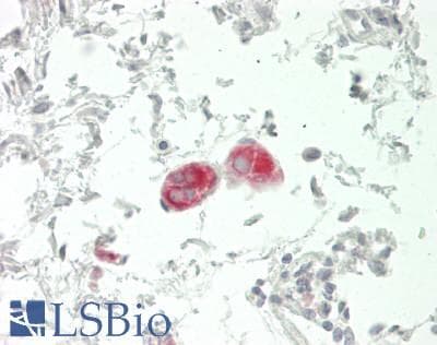 IHC-plus™ Polyclonal Rabbit anti-Human SLC6A1 / GAT-1 Antibody (Internal, IHC, WB)