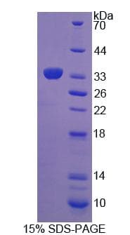 Rat LSP1 Protein (Recombinant His-T7)