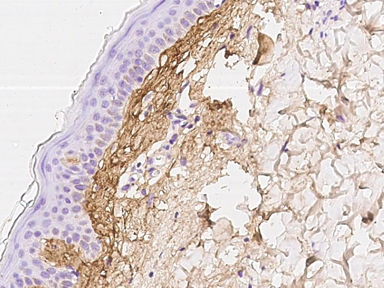 POSTN / Periostin Antibody