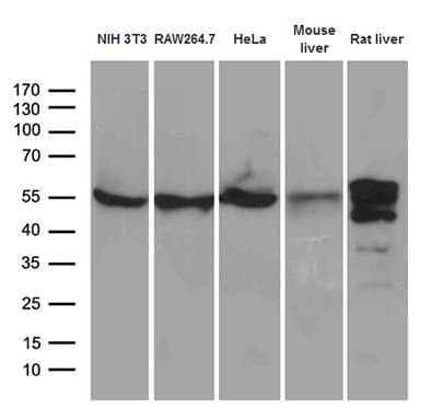 TRXR1 / TXNRD1 Antibody (clone OTI3E1)