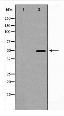 CRFR1 / CRHR1 Antibody