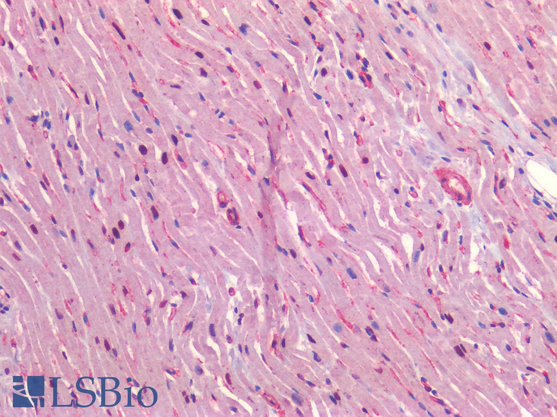 PathPlus™ Polyclonal Rabbit anti-Human CAV1 / Caveolin 1 Antibody (N-Terminus, IHC)