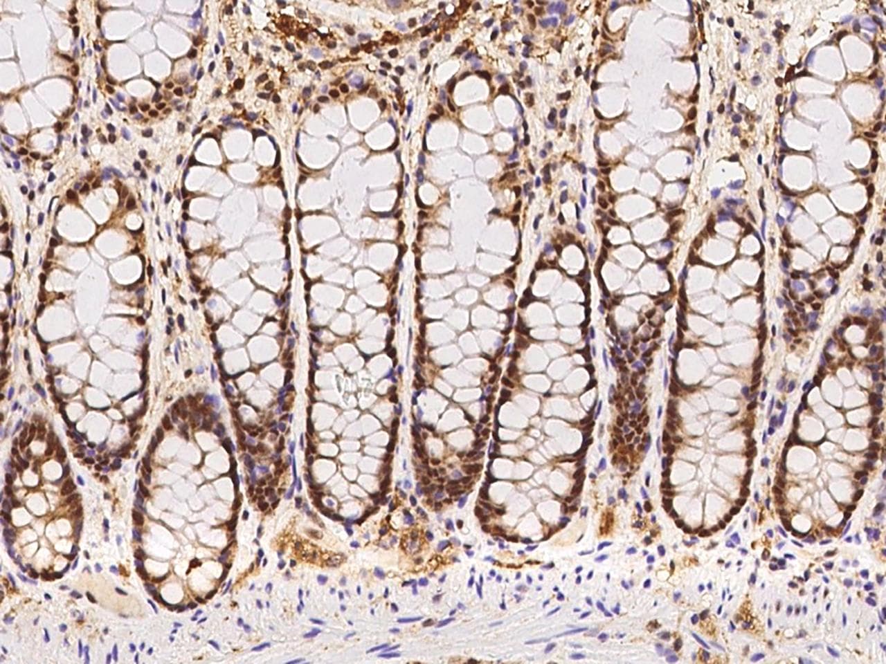 RAP30 / GTF2F2 Antibody