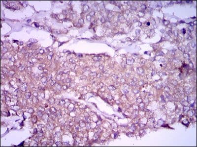 Monoclonal Mouse anti-Human GPC3 / Glypican 3 Antibody (clone 9C2, IHC, IF, WB)