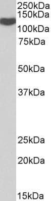 IHC-plus™ ADAM19 Antibody (aa574-588)