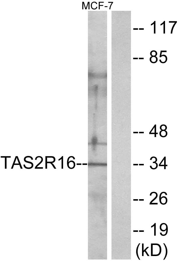 TAS2R16 / T2R16 Antibody (aa136-185)