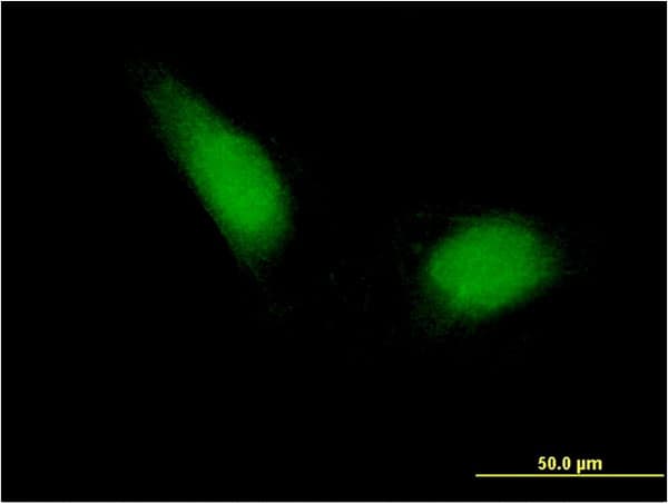 Monoclonal Mouse anti-Human ETS1 / ETS-1 Antibody (clone 2G10, IF, WB)