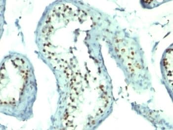 NCL / Nucleolin Antibody (aa364-365, clone 364-5 + NCL/902, Ready-to-Use)