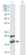 PTN / Pleiotrophin Antibody (clone 2E3)