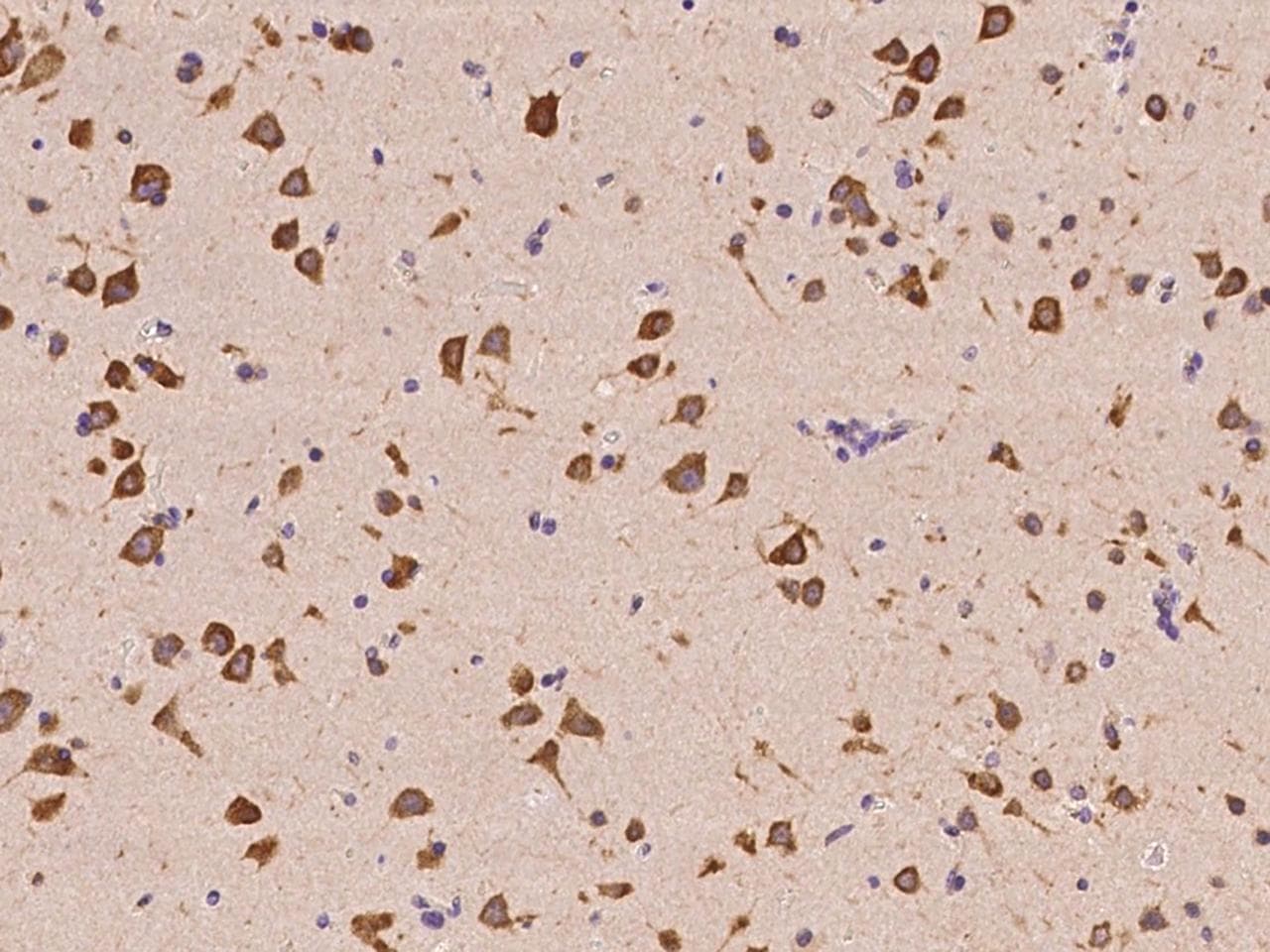 Polyclonal Rabbit anti-Human EIF4G1 / EIF4G Antibody (IHC, IF)