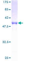 Human RPIA / RPI Protein (Recombinant GST)