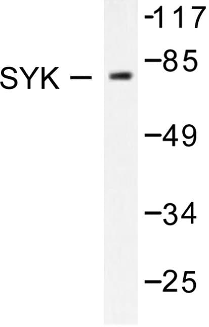 Polyclonal Rabbit anti-Human SYK Antibody (Leu519, IHC, WB)