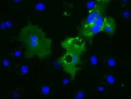 Monoclonal Mouse anti-Human L1CAM Antibody (clone OTI2B11, IF, WB)