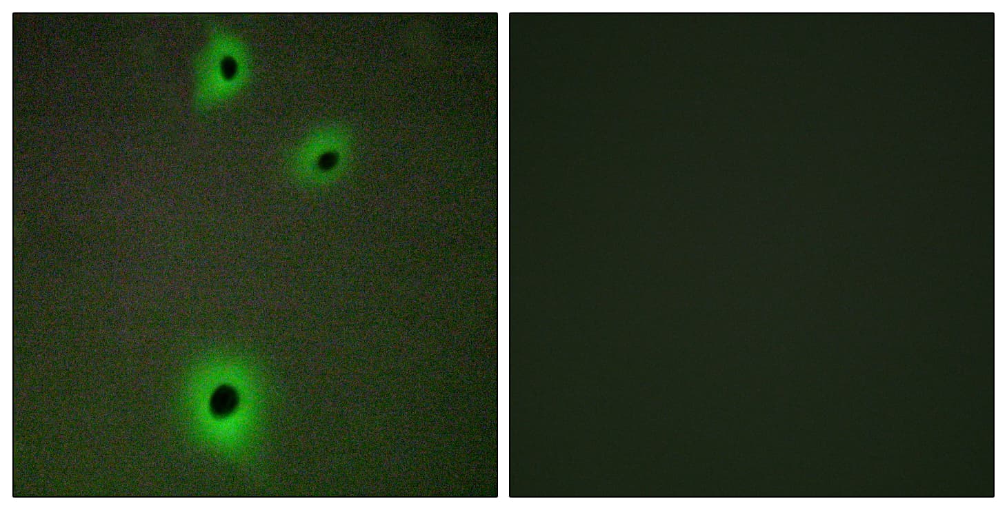 PathPlus™ Polyclonal Rabbit anti-Human IGSF4C / CADM4 Antibody (aa339-388, IHC, IF, WB)