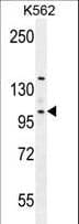 Villin-Like / VILL Antibody (aa385-412)