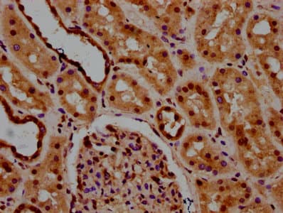 LSM8 / NAA38 Antibody