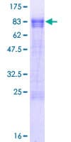 Human PPHLN1 Protein (Recombinant GST)