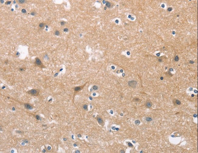 CDC25B Antibody