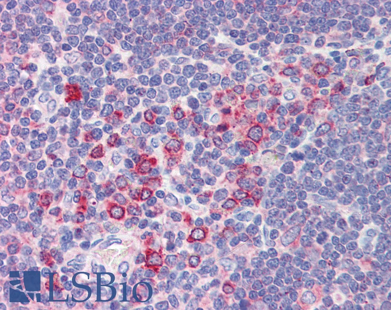 Polyclonal Rabbit anti-Human BCL11A Antibody (N-Terminus, IHC, WB)