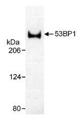 TP53BP1 / 53BP1 Antibody (C-Terminus, Biotin)