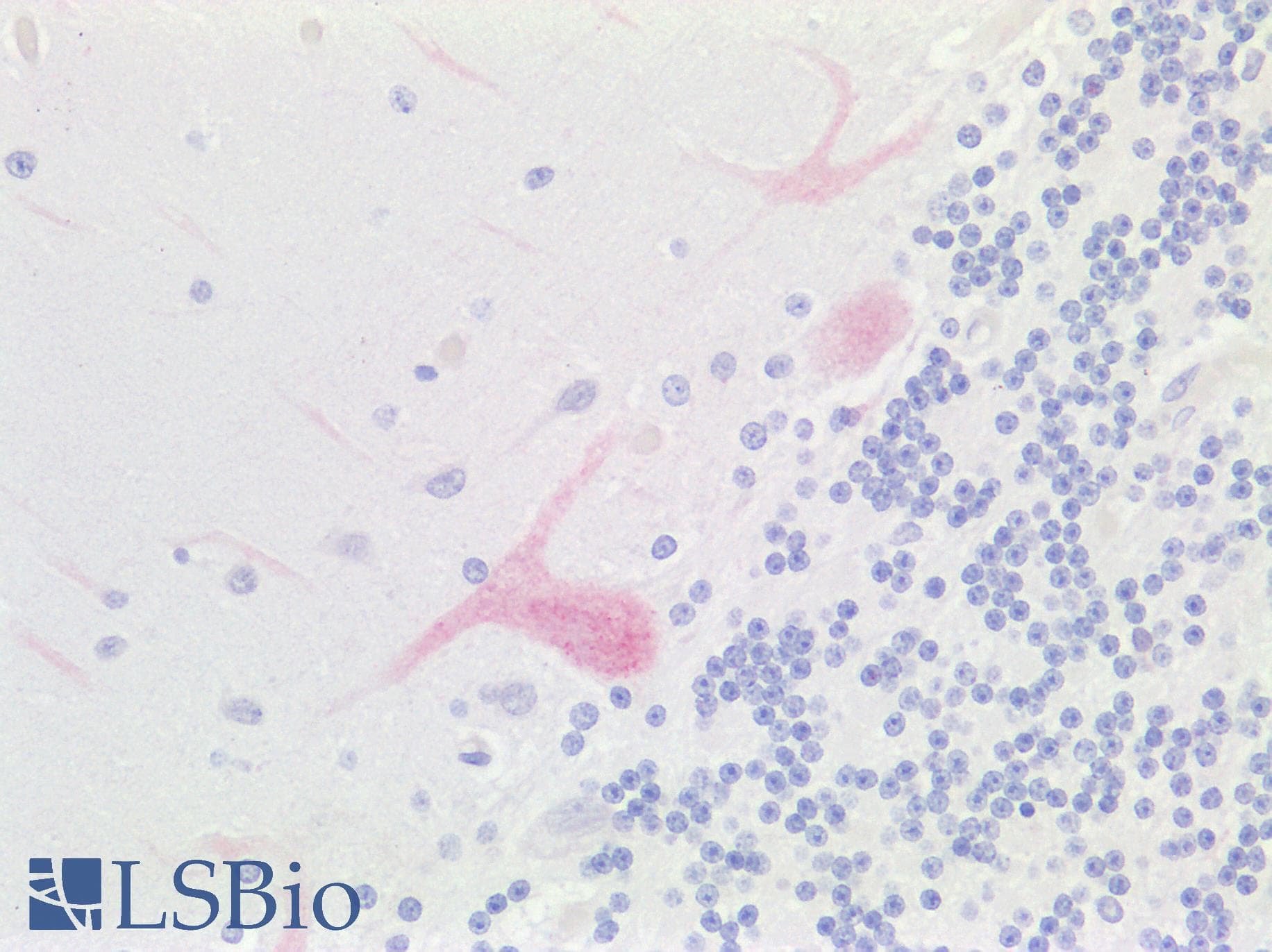 HAPLN1 Antibody (aa35-84)