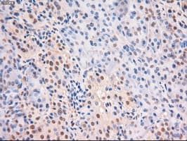 MYC / c-Myc Antibody (clone OTI5G3)