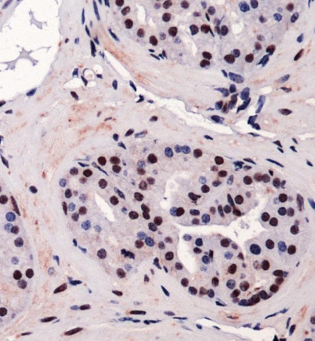 CBFA1 / RUNX2 Antibody (DY550)