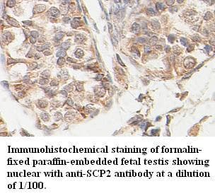 SCP2 / SCPX Antibody