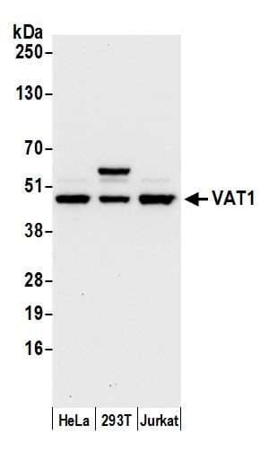 Polyclonal Rabbit anti-Human VAT1 Antibody (aa1-50, WB)