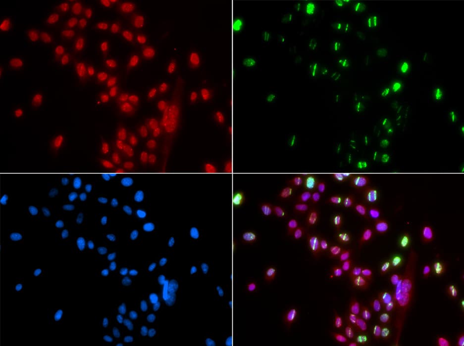 RNF2 / RING2 / RING1B Antibody