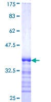 Human HIP1R Protein (Recombinant GST, N-terminus)